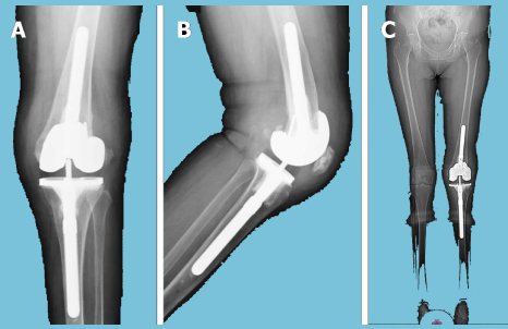 Orthopedic Specialist in bangalore
